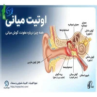 اوتیت میانی